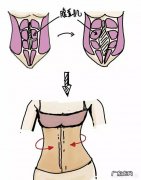 产后多久需要绑束腹带？要怎么绑比较好？