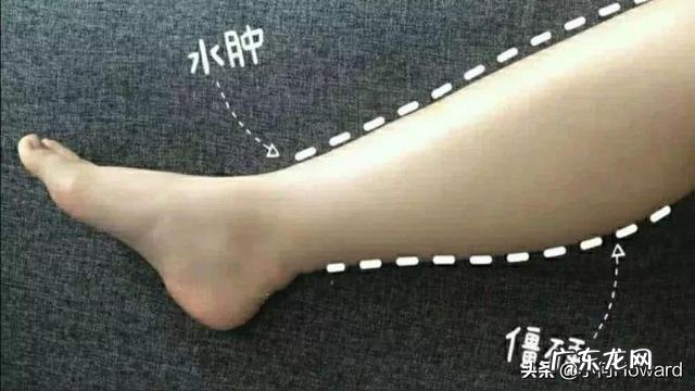 每天做仰卧举腿,一个月后有什么变化?