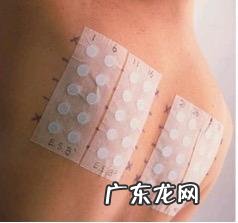 脸上总长痘痘是怎么回事,该怎么办?