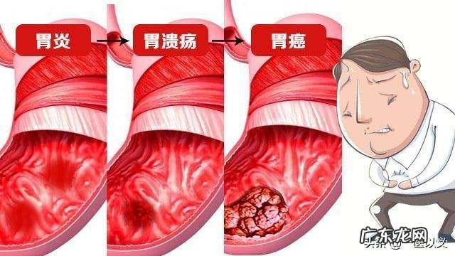 胃癌的患者是不是很消瘦呢?