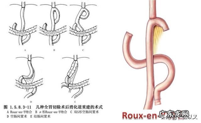 胃癌的患者是不是很消瘦呢?