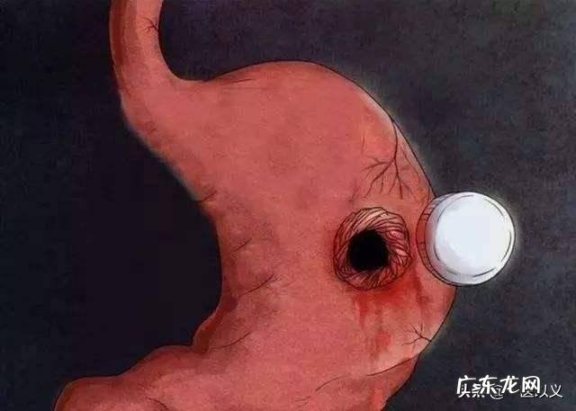 胃癌的患者是不是很消瘦呢?