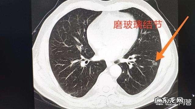 活动量大了后背肌肉疼,肋骨疼是怎么回事?跪求解答谢谢?