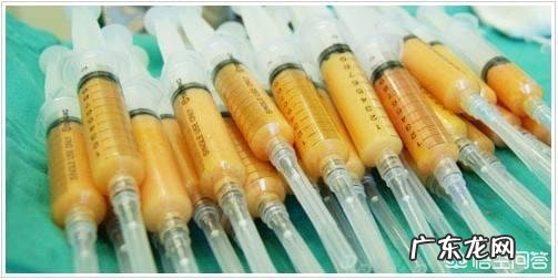 自体脂肪丰臀效果怎么样?