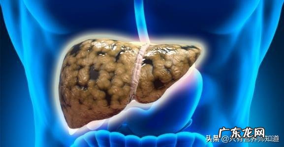 患有脂肪肝的人每天能吃花生吗?