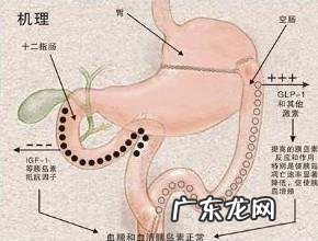 胰岛素抵抗一定发生在胖子身上吗?