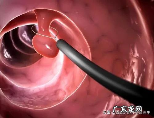 哪几类食物容易诱发癌症?