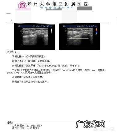 乳腺结节3ji中药调理有效果吗 乳腺纤维瘤喝中药会好吗？