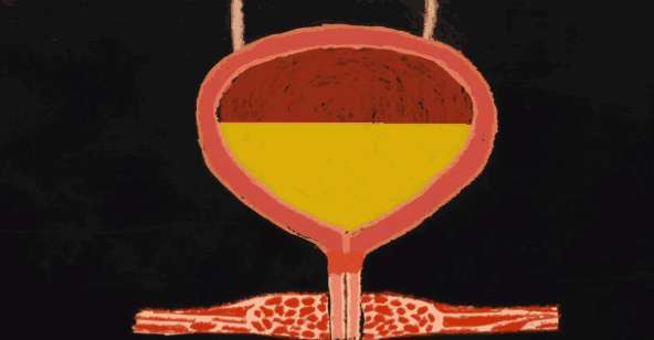 走路快的人，是好还是不好呢