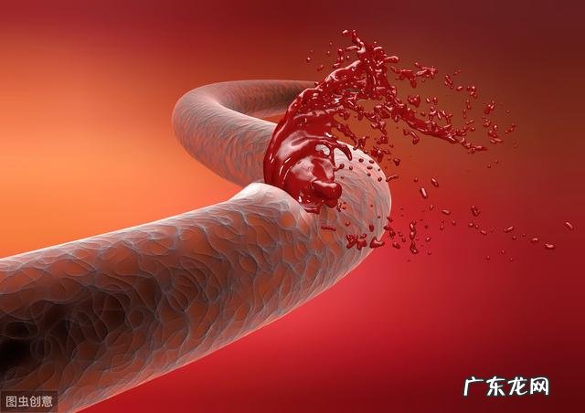 脑出血导致一侧偏瘫,能康复吗?