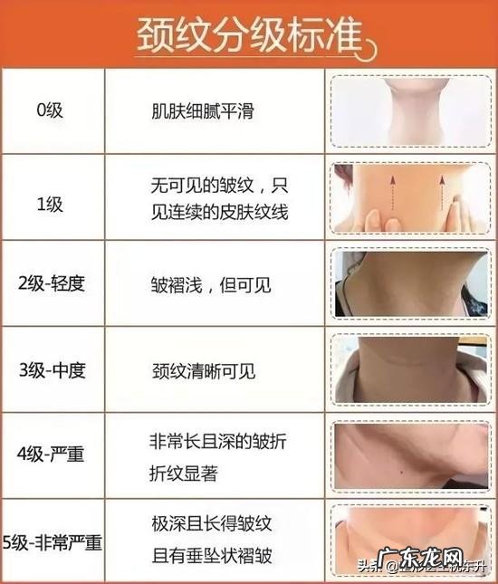 颈部的颈纹怎么办呀,有什么好方法可以防止颈部衰老吗?