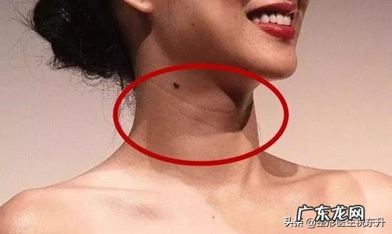 颈部的颈纹怎么办呀,有什么好方法可以防止颈部衰老吗?