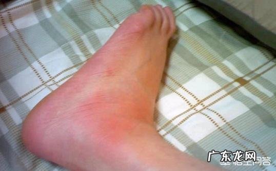 吃什么食物能降尿酸?常用食物嘌呤大全表上都有哪些食物?