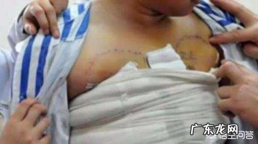 人有多种疾病,是吃出来的吗?