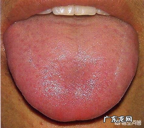 如何判断舌头健康状况 如何根据舌头辨别自己健康情况，该如何条理身体？