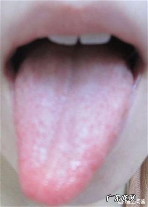 如何判断舌头健康状况 如何根据舌头辨别自己健康情况，该如何条理身体？