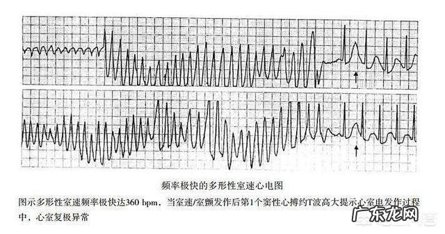 午餐之前可以吃碧生源奥利司他吗?