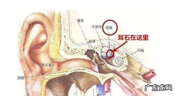 耳石症是怎么得的怎么zhi疗 耳硬化症和耳石症的区别是什么?