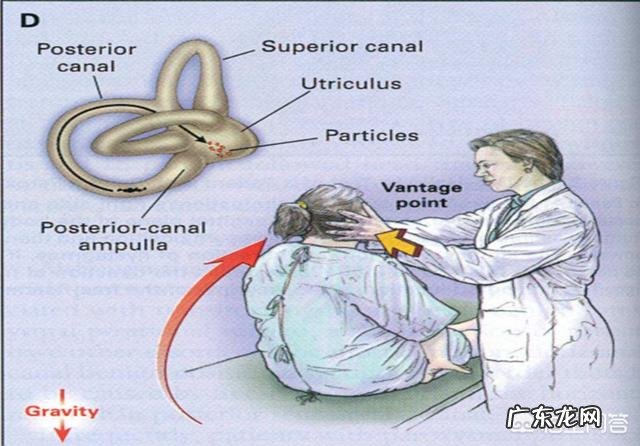 耳石症是怎么得的怎么zhi疗 耳硬化症和耳石症的区别是什么?
