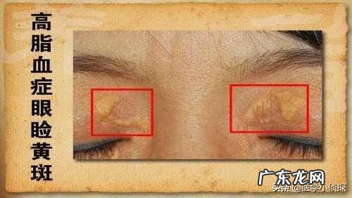 一般多少岁绝经正常?快绝经的时候会有什么状况?