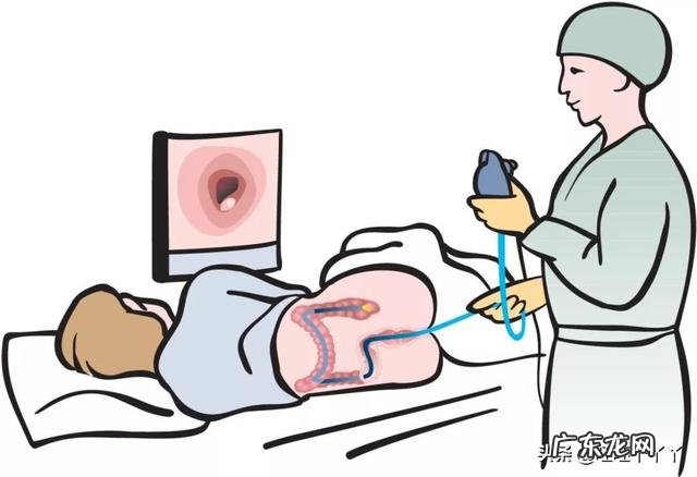 肠癌早期是肚子疼腹泻与干硬大便交替出现吗?