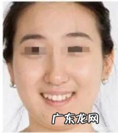 市面上声称能瘦脸的精华产品真的有用吗？