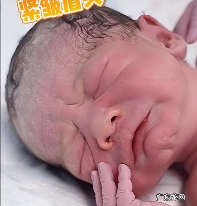 婴儿出生时身体会发生什么-婴儿出生有哪些现象