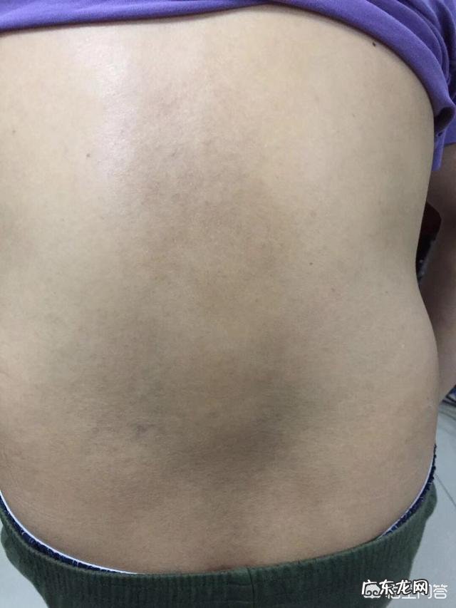 怎样在短期内快速健康地祛除女性的湿气?