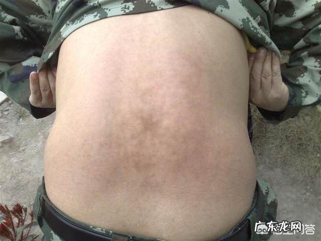 怎样在短期内快速健康地祛除女性的湿气?