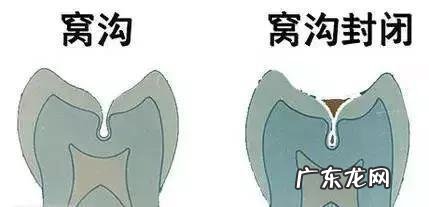 怎么样才能保护好一口好的牙齿-如何能保证换一口好牙齿