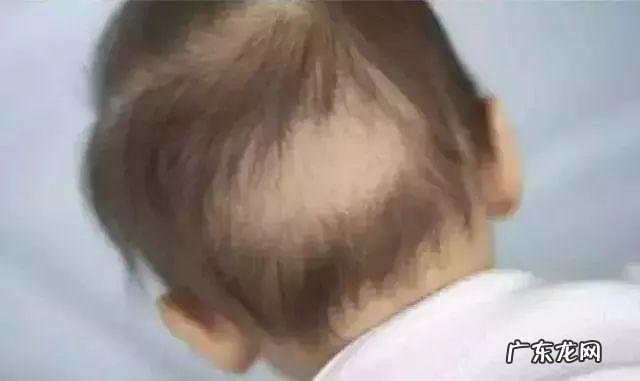 新生儿特殊五种生理现象-新生儿的特殊的生理表现