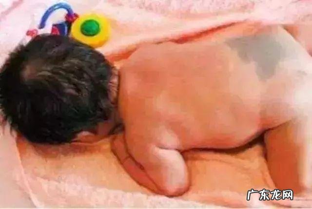 新生儿特殊五种生理现象-新生儿的特殊的生理表现