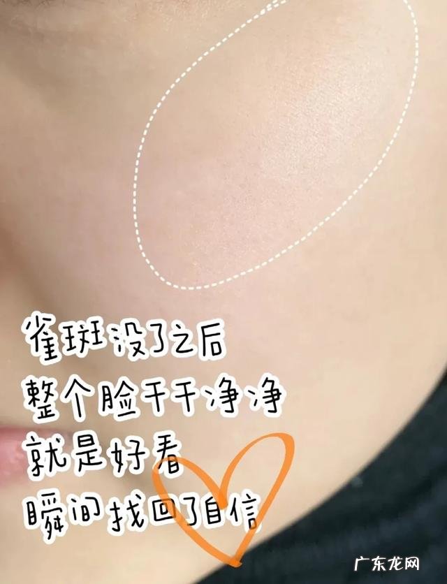 脸上有斑,有好的祛斑霜吗?推荐一下,或者有自制的去斑妙招?