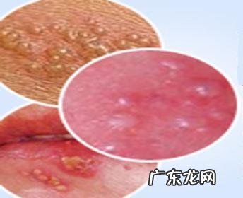 女人宫寒应该注意些什么?