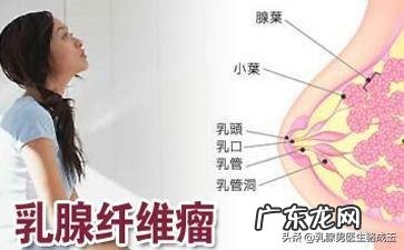 60岁女性患乳腺肿瘤有什么症状 20岁女孩怎么会有乳腺肿瘤?有哪些原因造成?