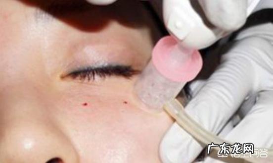 做完水光针之后多久可以做激光美容