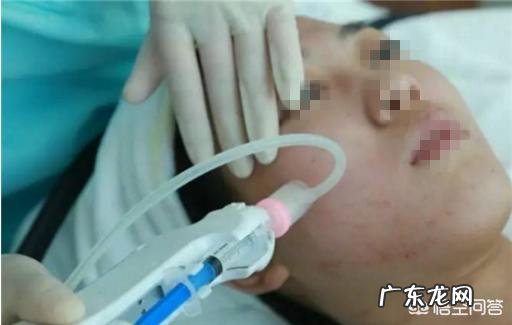 做完水光针之后多久可以做激光美容