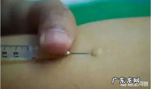 做完水光针之后多久可以做激光美容