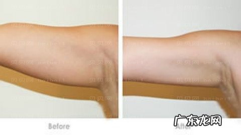 华韩华美整形医院怎么样?靠谱吗?