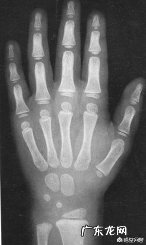 生长激素有什么副作用呢？