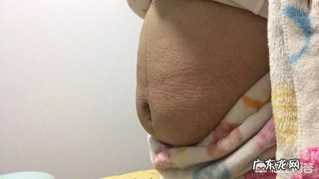 经常坚持做什么样的运动,可以帮助产妇瘦肚子?