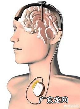 缺血性心肌病安装起搏器的获益能有多大?