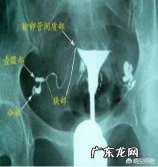 手脚冰凉的女生，真的很难怀孕吗？