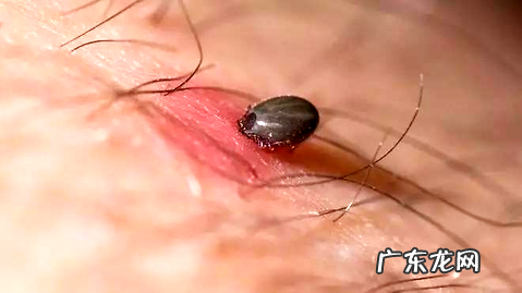 狗被蜱虫咬了怎么办？教你一个快速有用的方法