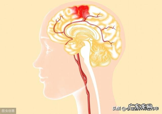 脑溢血吃什么食物好得快?