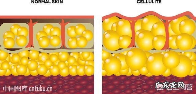 有人说皮肤松弛和吃甜食有关，是真的吗有什么依据