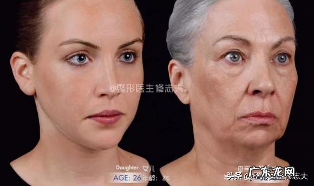 下颌角部位脂肪多怎么消除？