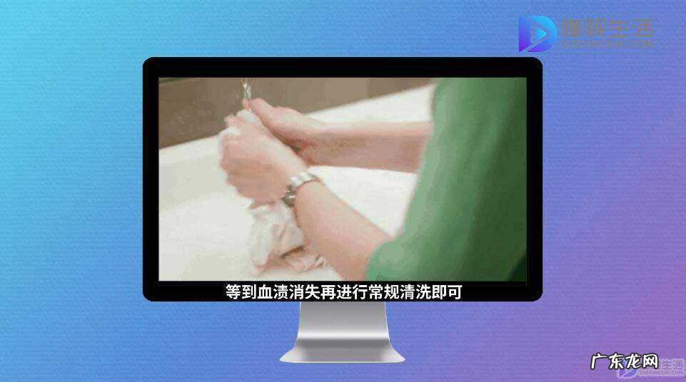 裤子上的旧血迹怎么洗? 衣服上的陈旧血迹怎么洗掉