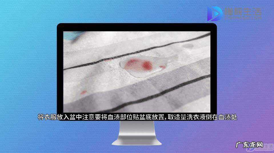 裤子上的旧血迹怎么洗? 衣服上的陈旧血迹怎么洗掉