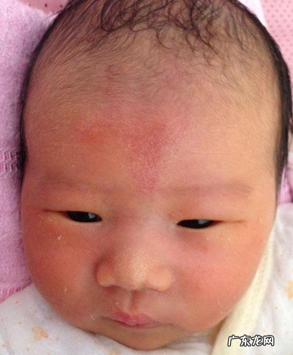 新生儿这28个异常表现都是正常的-新生儿6种看似异常表现